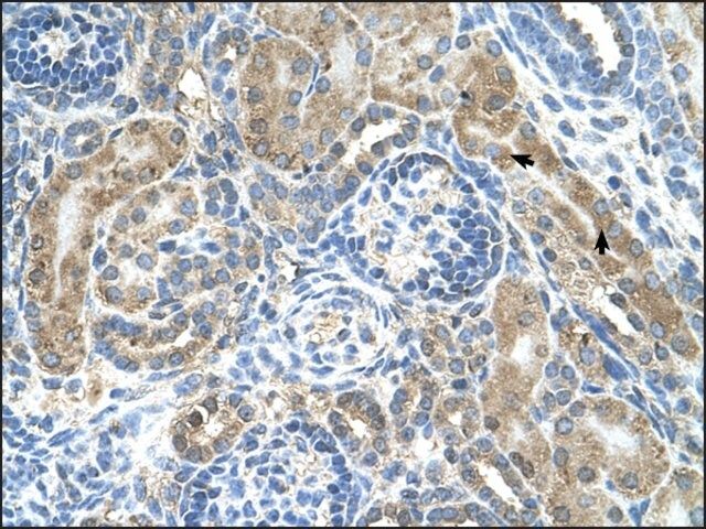 Anti-CRELD1 antibody produced in rabbit