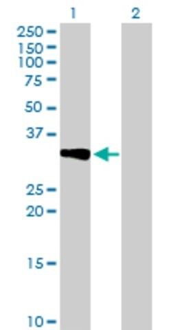 Anti-CRHBP antibody produced in mouse