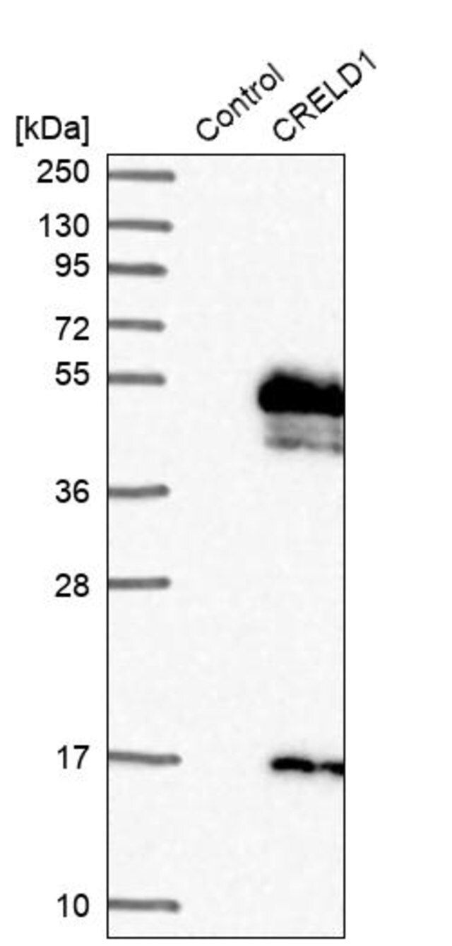 Anti-CRELD1 antibody produced in rabbit