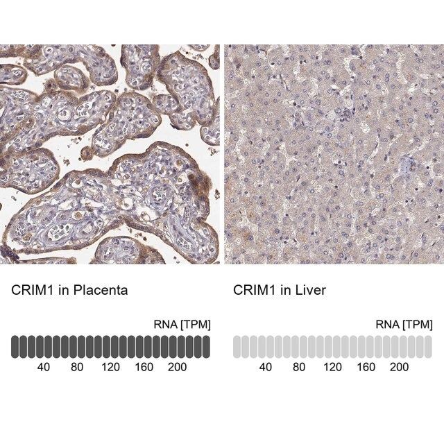 Anti-CRIM1 antibody produced in rabbit