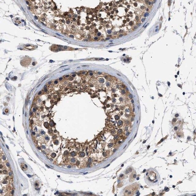 Anti-CRCP antibody produced in rabbit