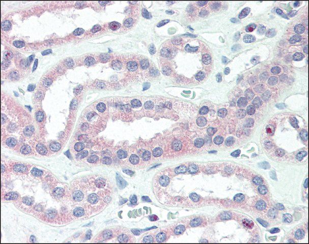 Anti-CRLF2 antibody produced in rabbit