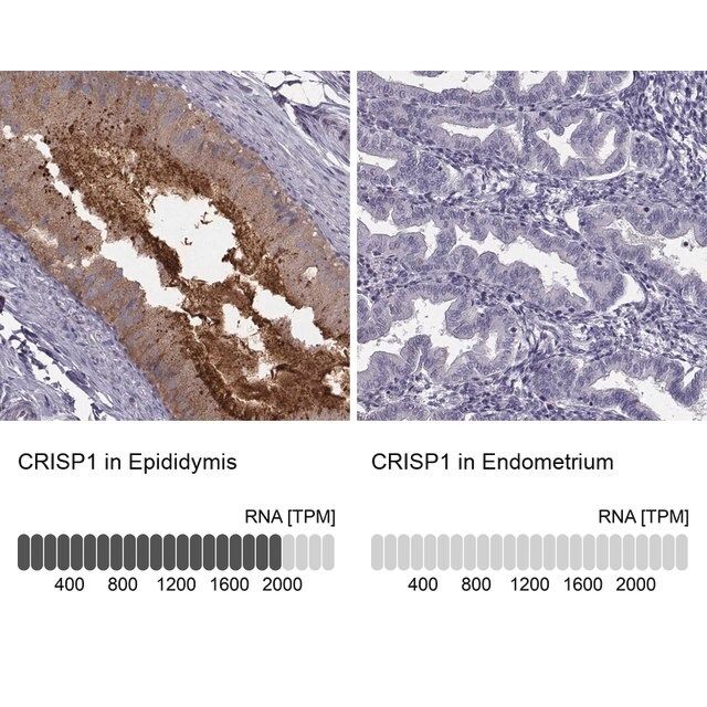 Anti-CRISP1 antibody produced in rabbit