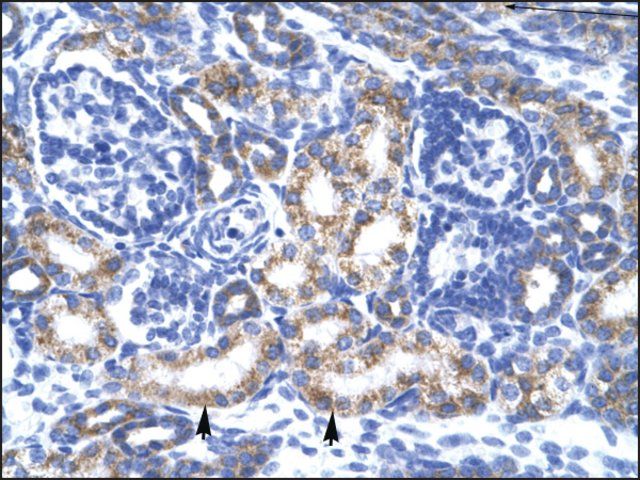 Anti-CREB3L2 antibody produced in rabbit