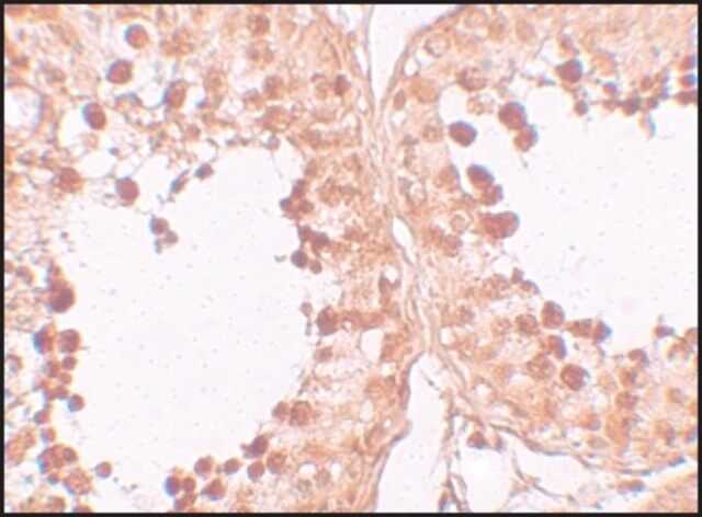 Anti-CRISP2 antibody produced in rabbit