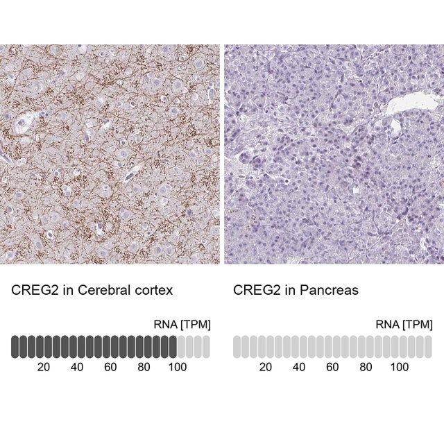 Anti-CREG2 antibody produced in rabbit