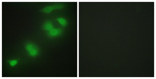 Anti-CREBZF antibody produced in rabbit