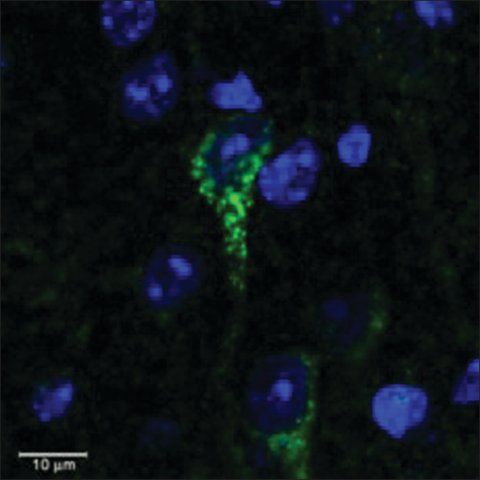 Anti-CRHR1/CRF-R (AA 107-117) antibody produced in goat