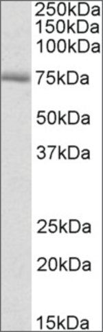 Anti-Crot (C-terminal) antibody produced in goat