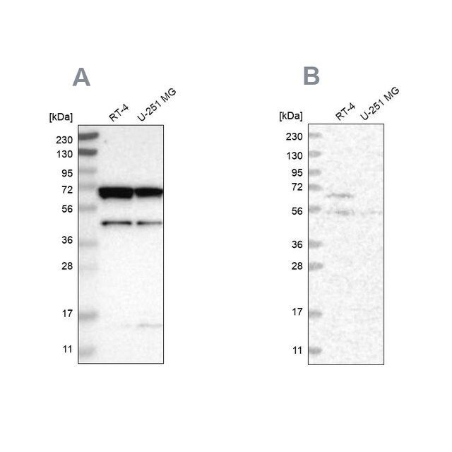 Anti-CROT antibody produced in rabbit