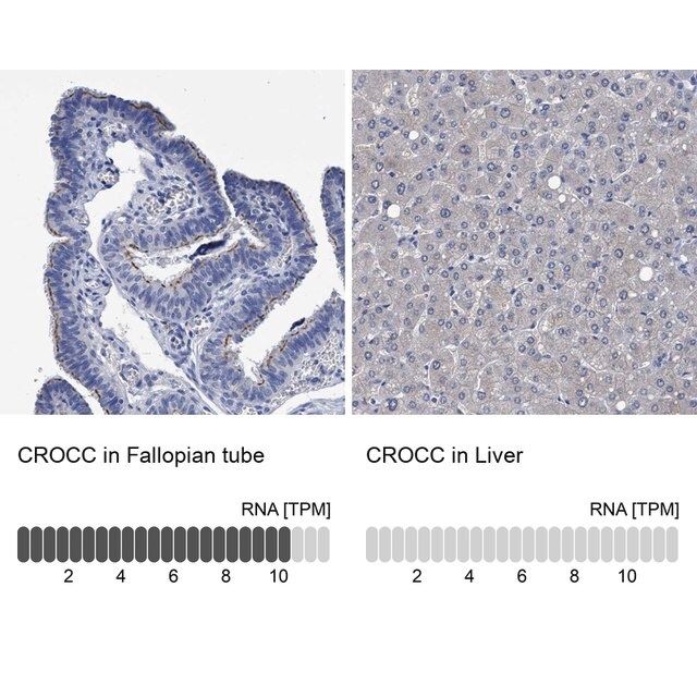 Anti-CROCC antibody produced in rabbit