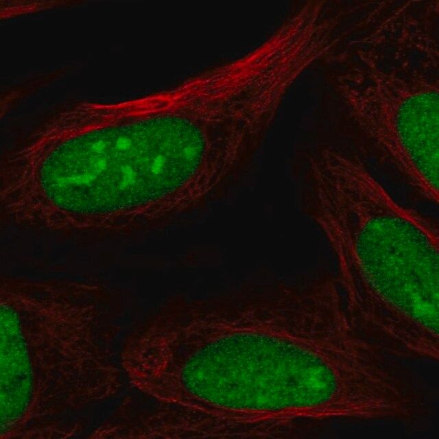 Anti-CRISPLD2 antibody produced in rabbit