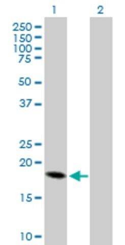 Anti-CRH antibody produced in mouse