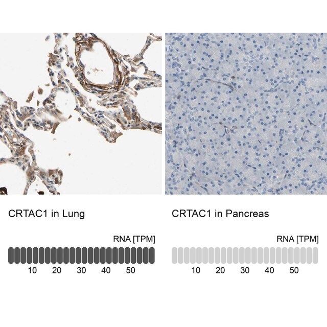 Anti-CRTAC1 antibody produced in rabbit