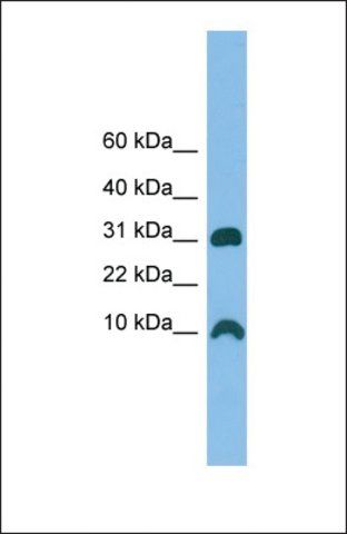 Anti-CRIP1 antibody produced in rabbit