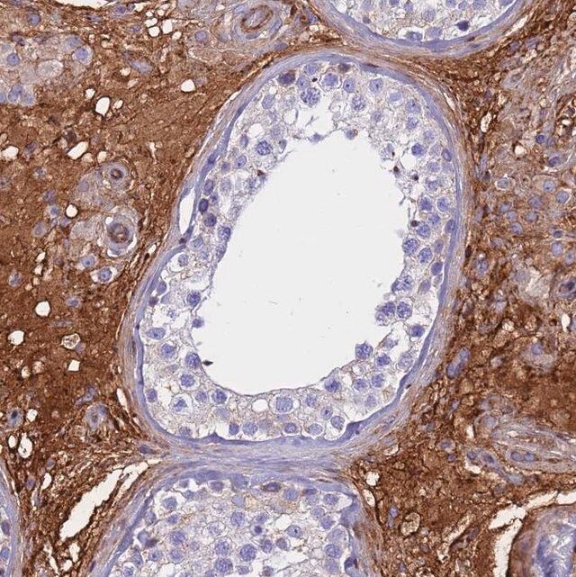 Anti-CRHBP antibody produced in rabbit