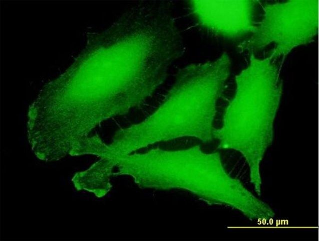 Anti-CRLF3 antibody produced in mouse