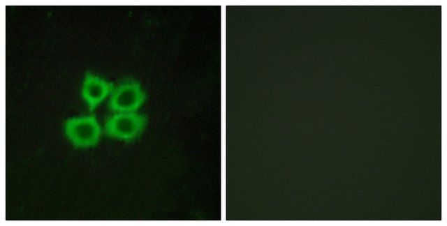 Anti-CRHR2 antibody produced in rabbit