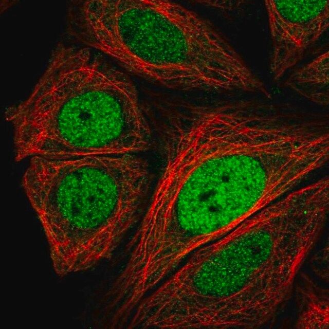 Anti-CRTC3 antibody produced in rabbit