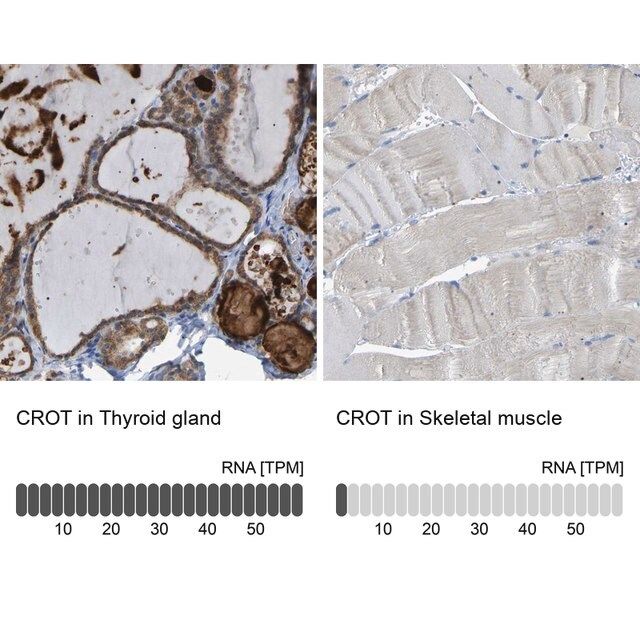 Anti-CROT antibody produced in rabbit