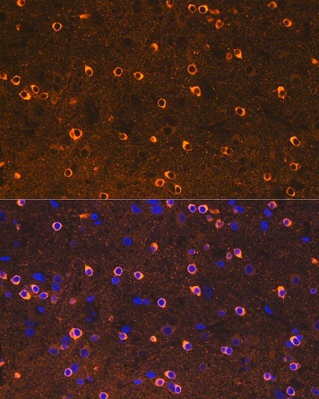 Anti-CRMP2/DPYSL2 antibody produced in rabbit