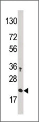 Anti-CROC1A (N-term) antibody produced in rabbit