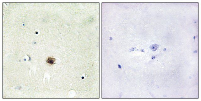 Anti-CRP1 antibody produced in rabbit