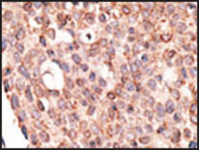 Anti-Cry2 (C-term) antibody produced in rabbit