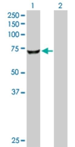 Anti-CROT antibody produced in rabbit