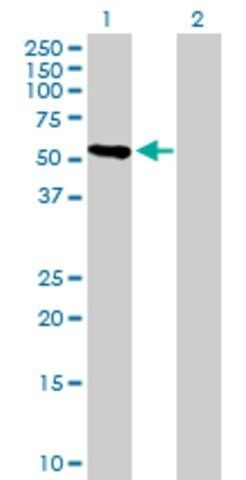 Anti-CRTAC1 antibody produced in mouse