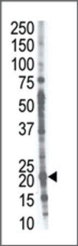 Anti-CROC1A (C-term) antibody produced in rabbit