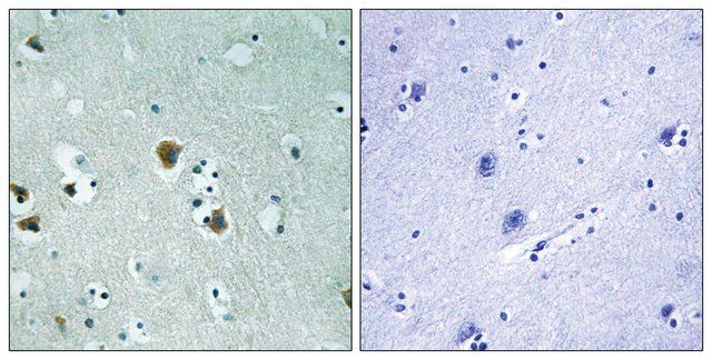 Anti-CRMP-2 antibody produced in rabbit