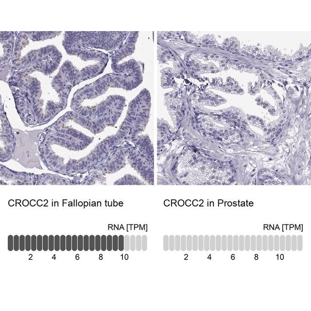 Anti-CROCC2 antibody produced in rabbit