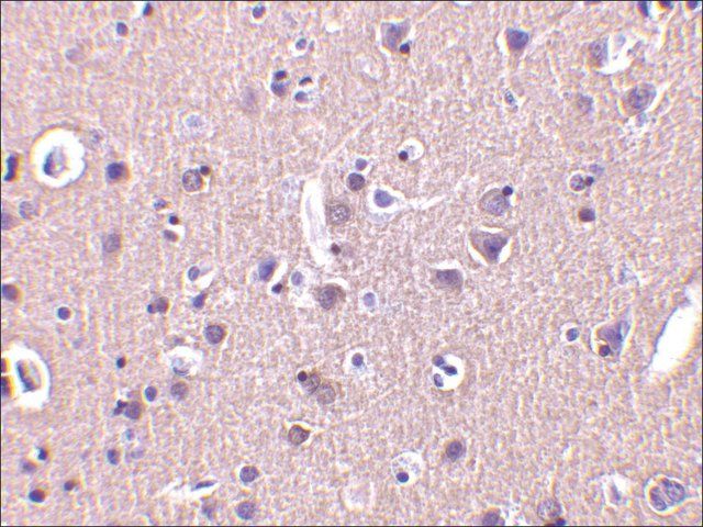 Anti-CRMP1 antibody produced in rabbit