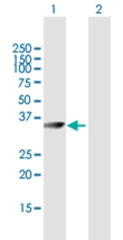 Anti-CRYM antibody produced in mouse