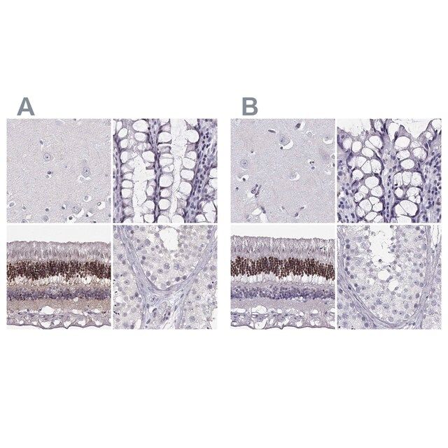 Anti-CRX antibody produced in rabbit