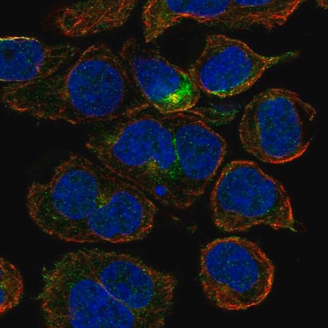 Anti-CRYGD antibody produced in rabbit