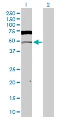 Anti-CSNK2A1 antibody produced in rabbit