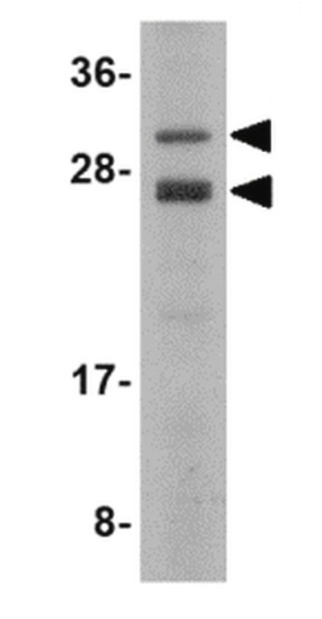 Anti-CSN8 Antibody