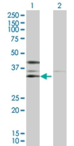 Anti-CSNK2A2 antibody produced in rabbit