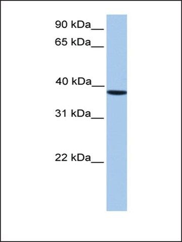 Anti-CSNK2A2