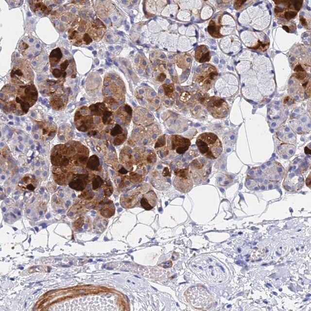 Anti-CST2 antibody produced in rabbit