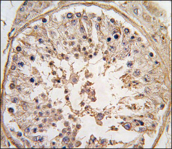 Anti-CSNK1A1L (N-term) antibody produced in rabbit