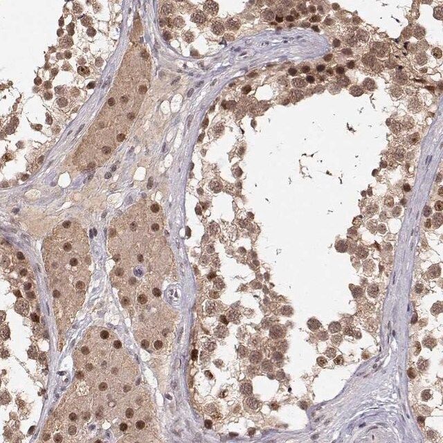 Anti-CSNK2A1 antibody produced in rabbit