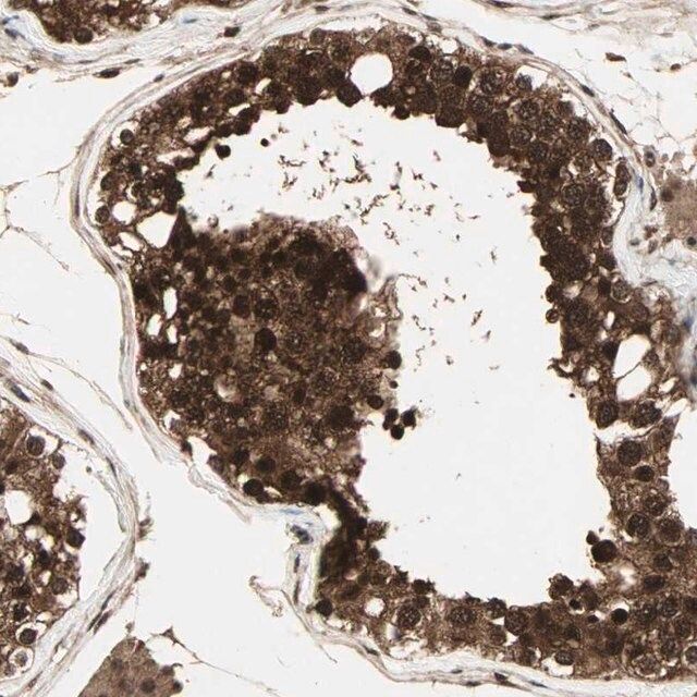 Anti-CSNK2B antibody produced in rabbit