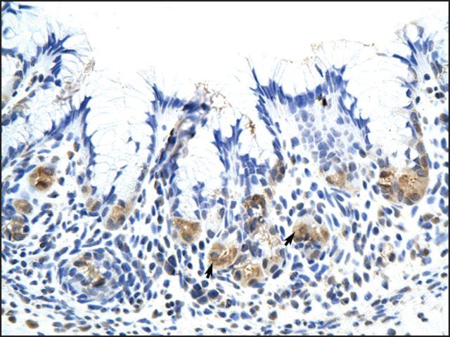 Anti-CSH1 antibody produced in rabbit