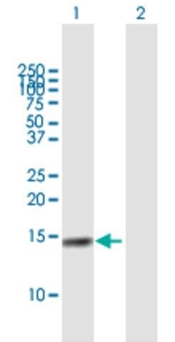 Anti-CST4 antibody produced in mouse