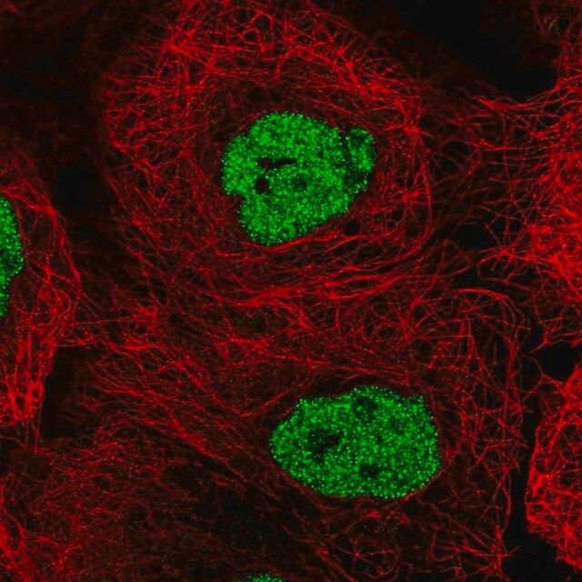 Anti-CSNK2A1 antibody produced in rabbit