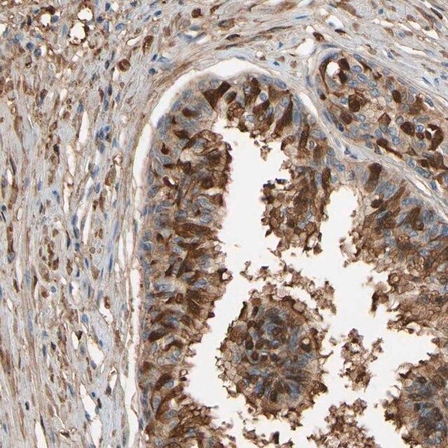 Anti-CSMD2 antibody produced in rabbit