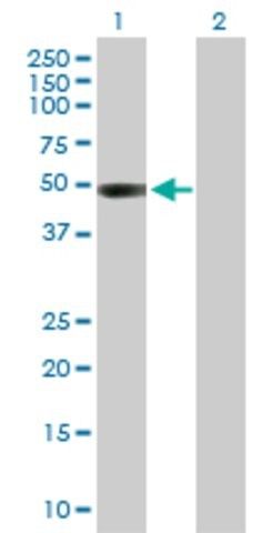 Anti-CTBS antibody produced in rabbit